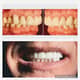 Slider image (9) Ideal Dental Mexico City